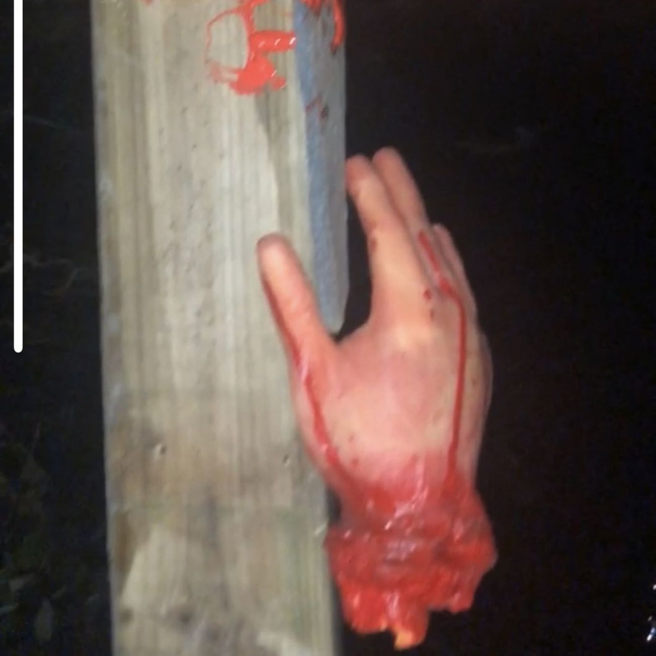 Kundbild på Avhuggen Hand med Blod Prop