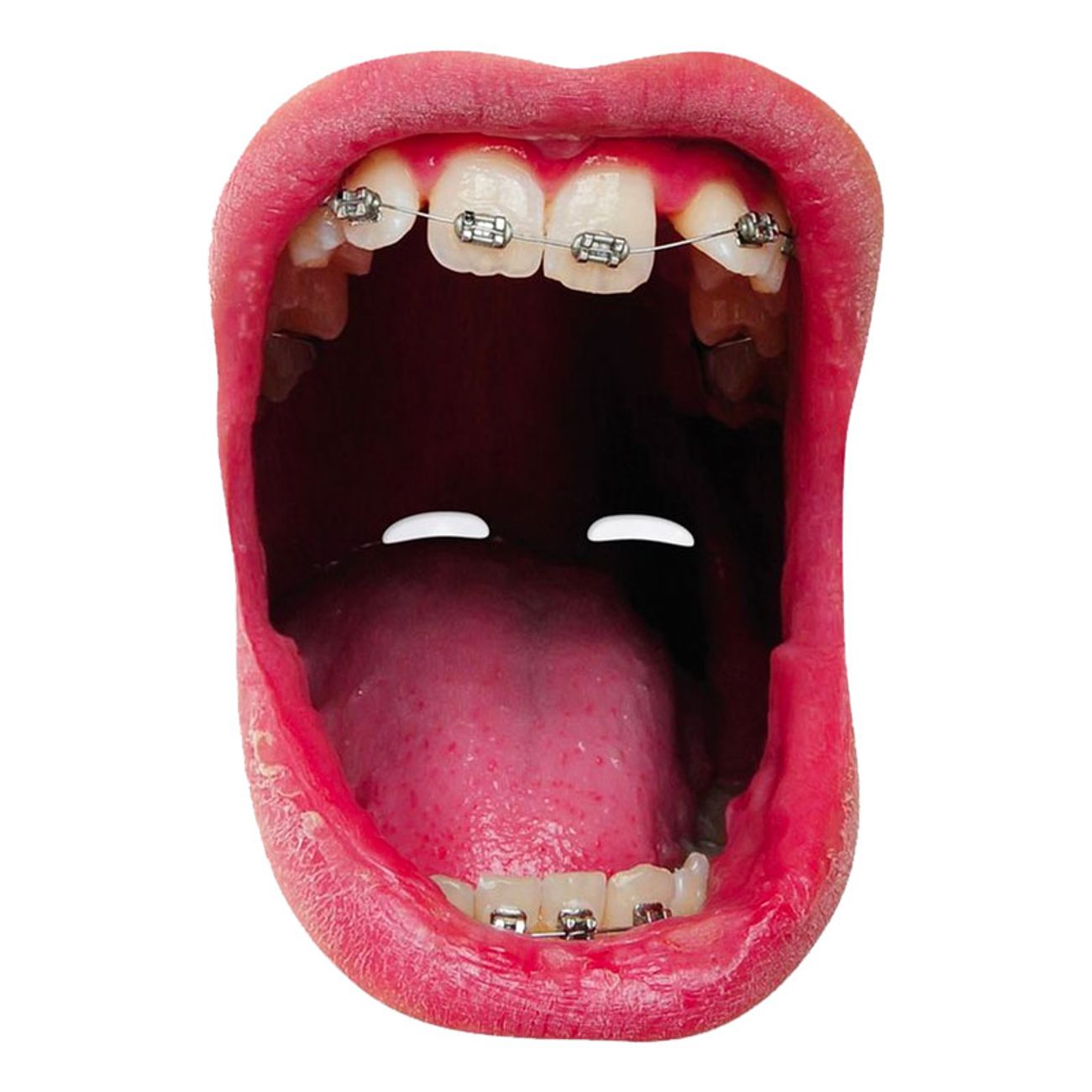 gapande-mun-med-tandstallning-pappmask-1