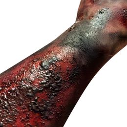 Bildspel - Grimas Brännsårspasta