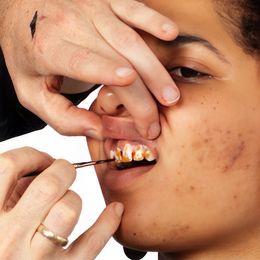 Bildspel - Kryolan Tandsvärta