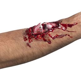 Åpent Beinbrudd Latexsår